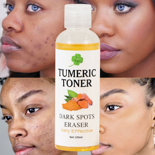 Dark Spots Eraser Turmeric Toner